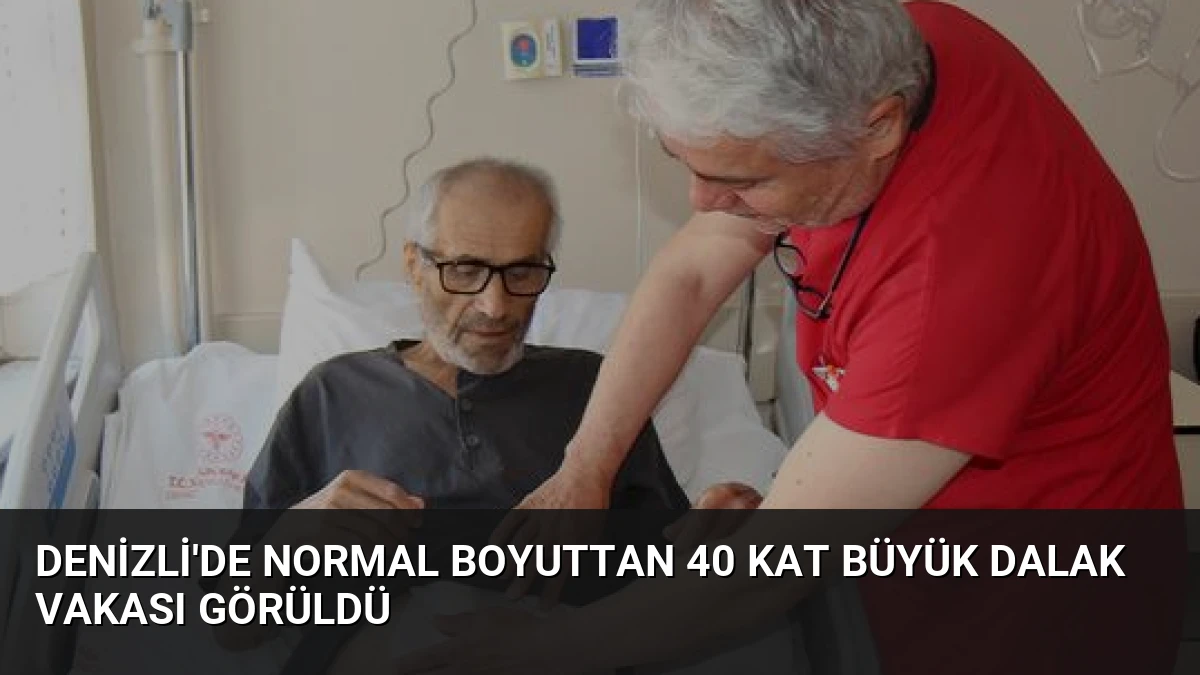 Denizli’de Normal Boyuttan 40 Kat Büyük Dalak Vakası Görüldü