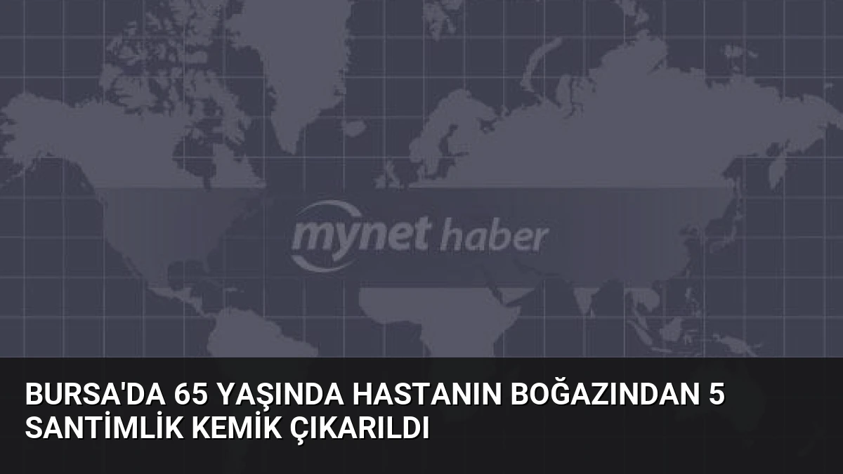 Bursa’da 65 Yaşında Hastanın Boğazından 5 Santimlik Kemik Çıkarıldı