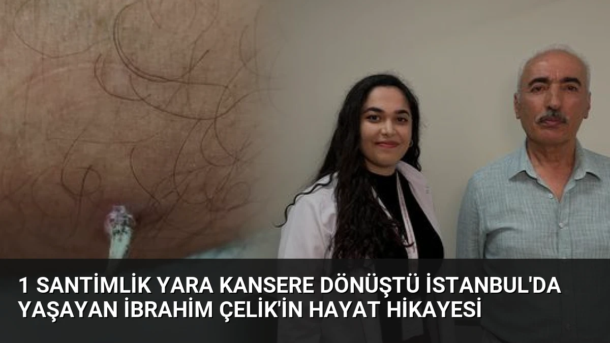 1 Santimlik Yara Kansere Dönüştü İstanbul’da Yaşayan İbrahim Çelik’in Hayat Hikayesi
